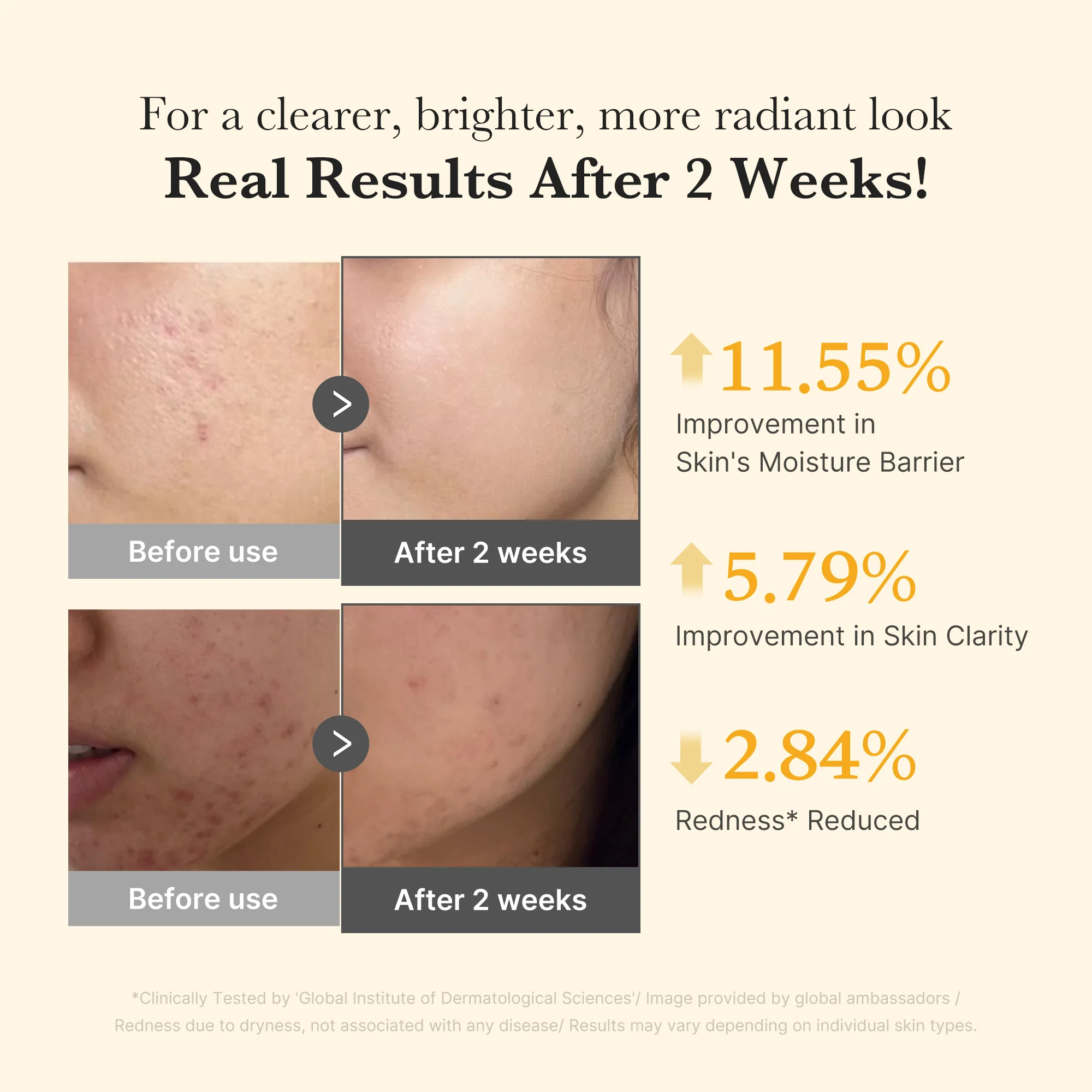 [GIFT] Kojic Acid Turmeric Capsule Serum - Image 4