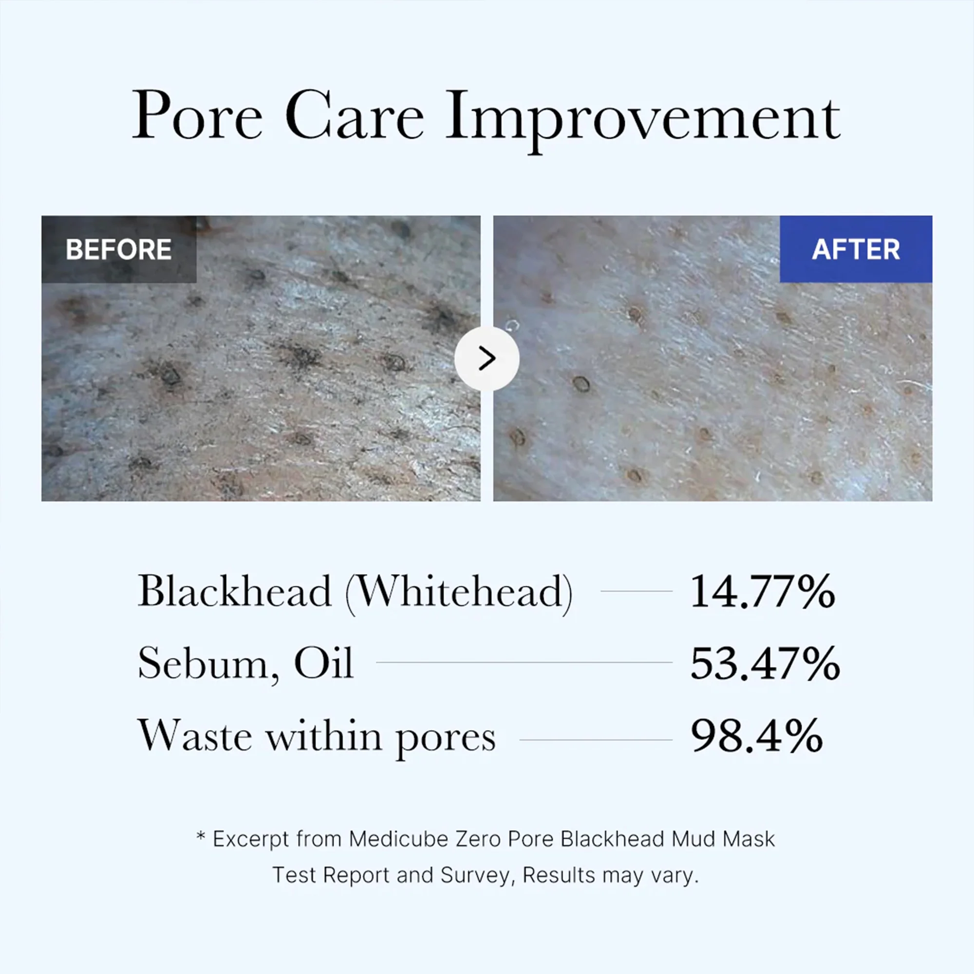 Zero Pore Blackhead Mud Mask - Image 5