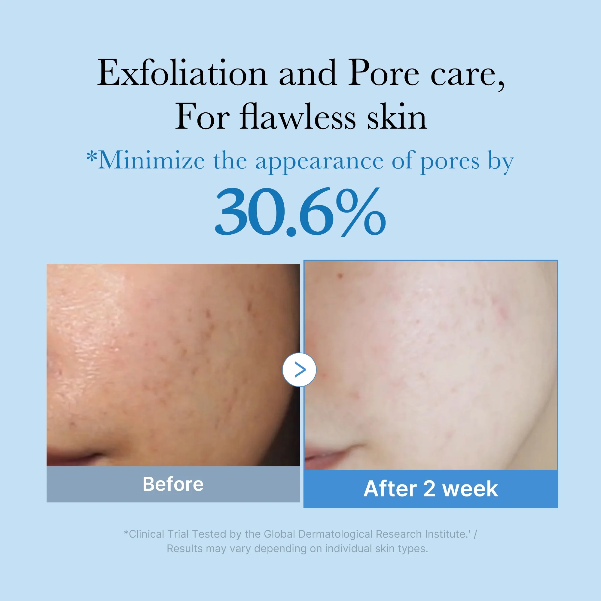 Zero Pore Toner - Image 2